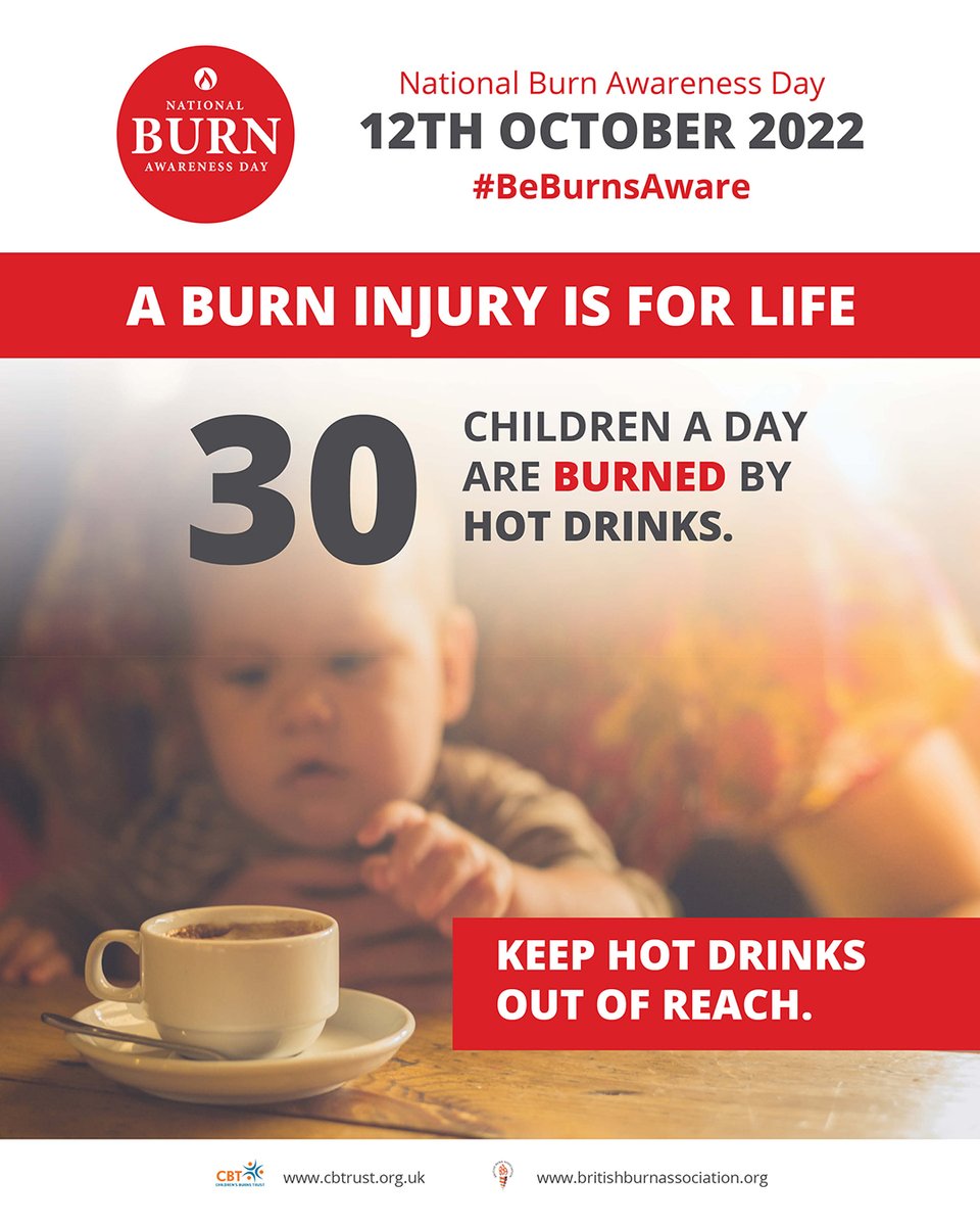 30 babies and toddlers go to the hospital with a hot drink burn every day. Keep hot drinks
out of reach.

zcu.io/qkYN

@BritishBurn  @CBTofficial 

#STOPTEABER #BeBurnsAware #FamilyOops #SavingLivesIsNotEnough #NBAD2022 #coolwater20mins