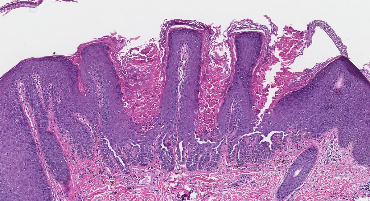 Jerad Gardner, MD on Twitter: 