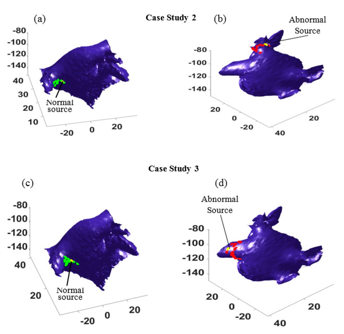 Bioeng_MDPI's tweet photo. An Uncertainty Modeling Framework for #Intracardiac #Electrogram Analysis 

by Amirhossein Koneshloo et al.

Free Reading: https://t.co/KRDzYdnXvT

Welcome to read and download! https://t.co/JcZmhYg4yN