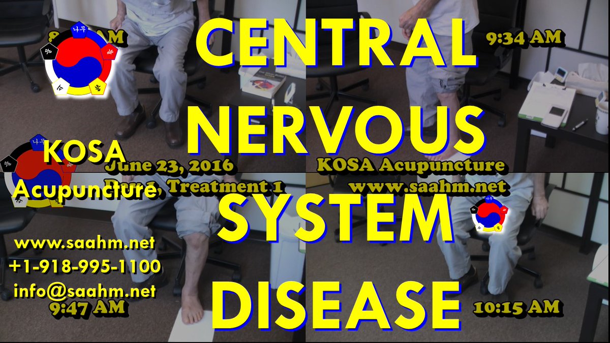 kosa_america's tweet photo. #CentralNervousSystemDiseaseTreatment By #KOSAAcupuncture https://t.co/dJE7XNaofr via @YouTube 
#acupuncturenearme https://t.co/H2ECxuo8Tv