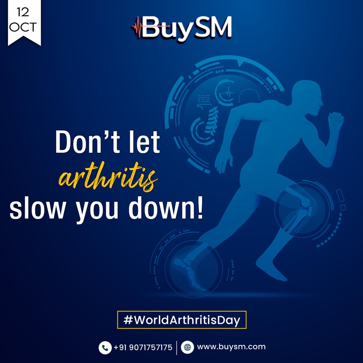 buysmofficials's tweet photo. Arthritis is not a single disease but a broad term for more than a hundred diseases related to joints. It is a condition involving inflammation of the joints.

#worldarthritisday #arthritis #arthritisrelief #arthritisawareness #curearthritis #buysm #follow https://t.co/ar39PFVD0o