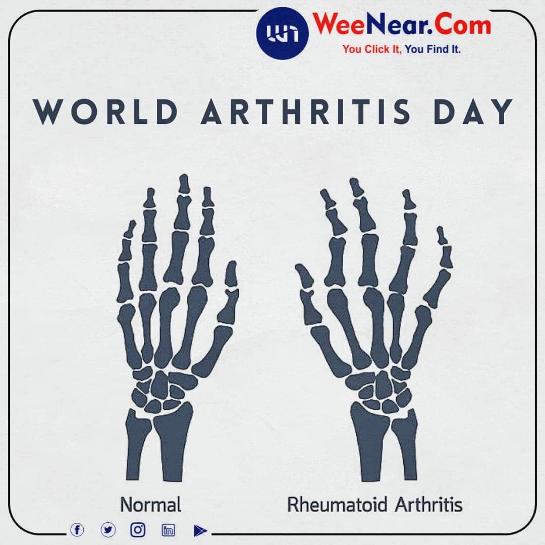 near_wee's tweet photo. World Arthritis Day!

#worldarthritisday 
#weenear https://t.co/8CP6JwNzpI