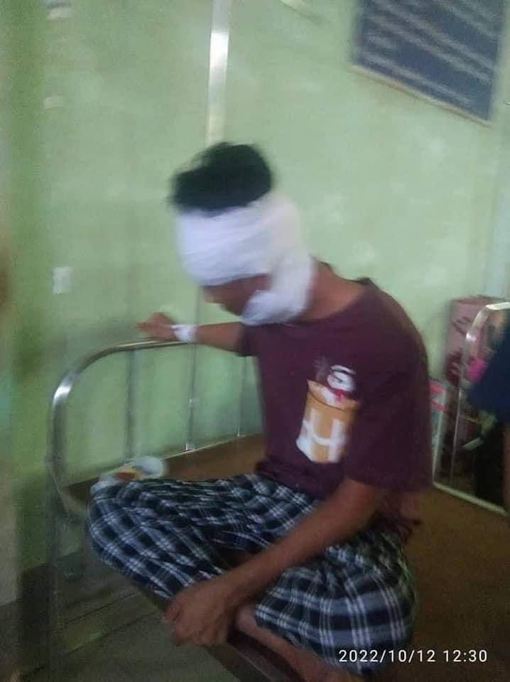 Khithitofficial's tweet photo. ကျိုက်ထီးရိုးဘုရား တောင်တက်ဂိတ်ရှိ စစ်ကောင်စီတပ်ဖွဲ့ဝင်များ ပစ်ခတ်ခံရပြီး စစ်သားနှင့်ရဲ ၁၅ ဦးခန့် ဒဏ်ရာရ၊ စစ်တပ်၏ ရမ်းသမ်းပစ်ခတ်မှုကြောင့် ပြည်သူ ၃ ဦးသေဆုံးပြီး ပြည်သူတချို့ ဒဏ်ရာရ 
Read more-> https://t.co/HNM1cY63M7 https://t.co/83LpfinKQW