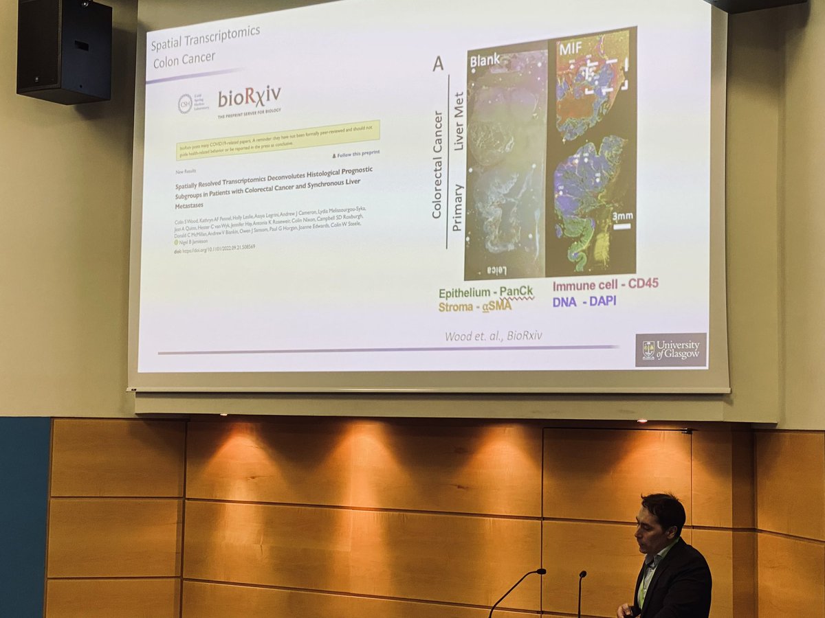 Nigel B. Jamieson (@nigeljamieson) on Twitter photo An outstanding and busy day at <a href="/RCSEd/">The Royal College of Surgeons of Edinburgh</a> with the @nanostringtech summit and European series
Powerful single cell data #cosmx presented by <a href="/joebeechem/">joe.beechem</a>
#bigdata
#everysinglecell
Glad to have contributed outputs from <a href="/LabSpatialNBJ/">Jamieson Spatial Lab</a> team <a href="/CVRinfo/">MRC-Uni of Glasgow Centre for Virus Research</a>
<a href="/WCIPGLASGOW/">Centre For Parasitology</a> <a href="/UofGCancerSci/">UofG Cancer Sciences</a> An outstanding and busy day at <a href="/RCSEd/">The Royal College of Surgeons of Edinburgh</a> with the @nanostringtech summit and European series
Powerful single cell data #cosmx presented by <a href="/joebeechem/">joe.beechem</a>
#bigdata
#everysinglecell
Glad to have contributed outputs from <a href="/LabSpatialNBJ/">Jamieson Spatial Lab</a> team <a href="/CVRinfo/">MRC-Uni of Glasgow Centre for Virus Research</a>
<a href="/WCIPGLASGOW/">Centre For Parasitology</a> <a href="/UofGCancerSci/">UofG Cancer Sciences</a>