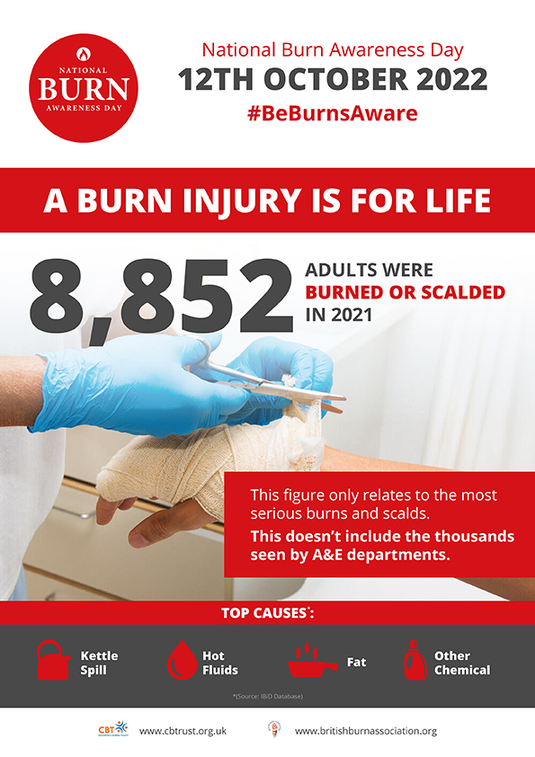 Prevention is key to reducing the number of burns and scalds each year. The right first aid will
reduce the scarring and injury.

 zcu.io/gt4a 

@BritishBurn  @CBTofficial 

#STOPTEABER #BeBurnsAware #FamilyOops #SavingLivesIsNotEnough #NBAD2022 #coolwater20mins