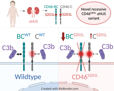 EurJImmunol's tweet photo. Novel homozygous CD46 variant with C-isoform expression affects C3b inactivation in atypical hemolytic uremic syndrome
Vivien R. Schack, Morten K. Herlin, Per Höllsberg, and Colleagues
#CD46 #C3b #atypicalhemolyticsyndrome
https://t.co/uon62o9Il1 https://t.co/w0VyBeFKKM