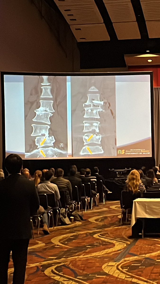 The room is filled to the back to hear Michael Wang of <a href="/UMiamiHealth/">UMiami Health System</a> discuss where to terminate a long fusion in the controversies symposia at #NASS2022.