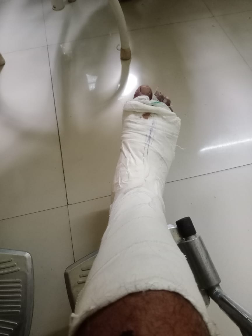 ShaikTgfwda's tweet photo. Dear @zomato Anjaneyulu delivery Worker should help it's Worker hurt after he completed your deliveries @zomatocare should speed up the insurance process for its workers. https://t.co/1ZMZ4HjugB