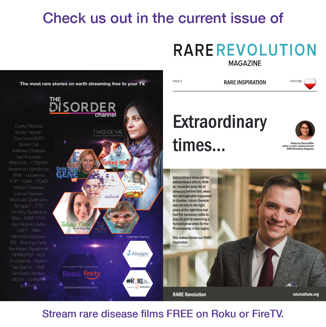 DisorderRare's tweet photo. Check out the ad for #TheDisorderChannel helping bring more awareness to #cysticfibrosis #AHP #acutehepaticporphyria #sicklecellawareness #menkesdiseae #usp7 #BBSOAS #ctnnb1 #angelmansyndrome #sma #FOP #giantaxonalneuropathy #wilsondisease #syngap1 & so many more through film https://t.co/XgUGeFqsZv