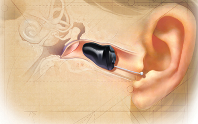 Xcellent Insights tweet media