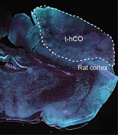 Sergiu_P_Pasca's tweet image. Glad to share our latest work out in @Nature today
We show that human cortical #organoids transplanted into the somatosensory cortex of newborn rats develop mature cell types and integrate into sensory circuits and can influence reward-seeking behavior 
nature.com/articles/s4158…