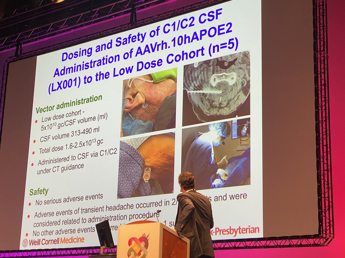 michael_duerr's tweet image. APOE4 gene is linked to higher risk for #Alzheimer Mike Kaplitt @WeillCornell presented first results on gene therapy with #AAV coding for APOE2 delivered via CSF to treat APOE4 #Alzheimer pts. Promising interim results #ESGCT2022