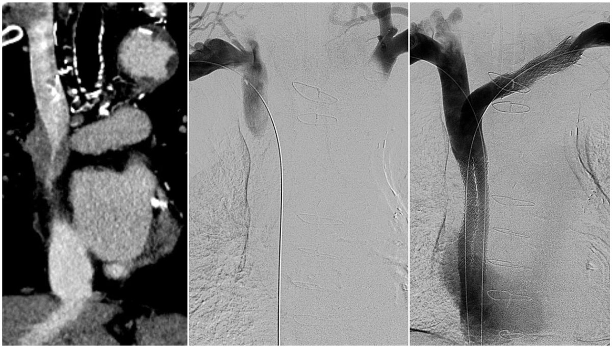 Jeffrey F. B. Chick, MD, MPH tweet media