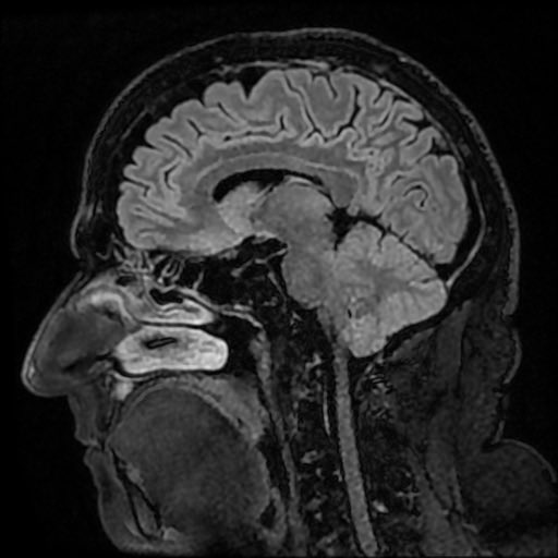 I passed the neurological exam today before my Car-T cell transplant. They used to ask “Who is the President of the United States?”, but they don’t ask that nowadays.