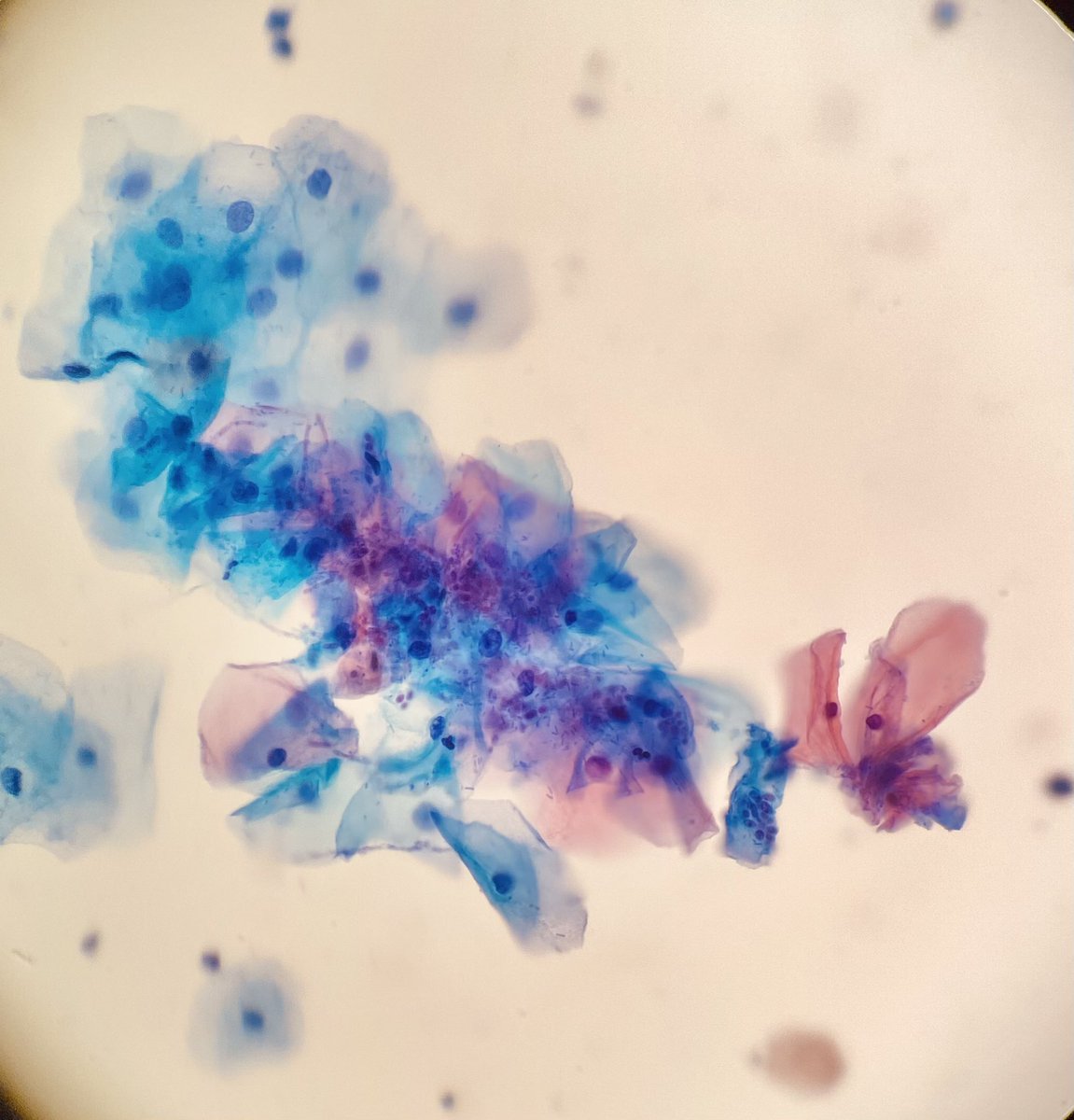 sinievdw's tweet photo. Werken op het #cytology Lab, verrijking voor de docent. Werkveld en opleiding goed verbonden met elkaar. #hybridedocent #rocmn https://t.co/wPPj0CWqAe