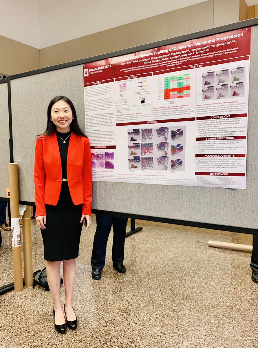 ElizabethRyanIU's tweet photo. Check out @IUMedSchool Northwest Campus student @glo_xue and her winning @IUCancerCenter research day abstract titled: "SPATIAL TRANSCRIPTOMIC PROFILING OF CUTANEOUS MELANOMA PROGRESSION."  Way to go Gloria! @BradalleL @paulwallach https://t.co/tGsHuTpGcN