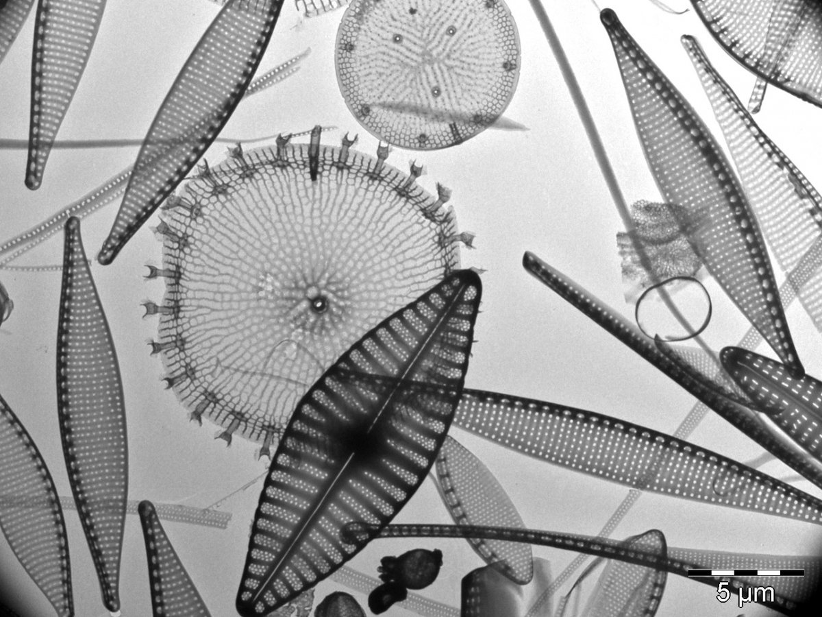 Happy #WorldAlgaeDay! This is a photo of a mixed diatom assemblage taken by Penelope Ajani, which won the microphotography category of our 2017 photo contest. Check out more photos of algal life on our website here: aslo.org/online-media-l…