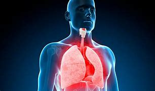 psevigny58's tweet photo. Je vous quitte pour un bout, je dors à l'hôpital ce soir, demain matin on me greffe des poumons !! 
Que la vie soit bonne ! Ciao ! https://t.co/A9Yhs5isPA
