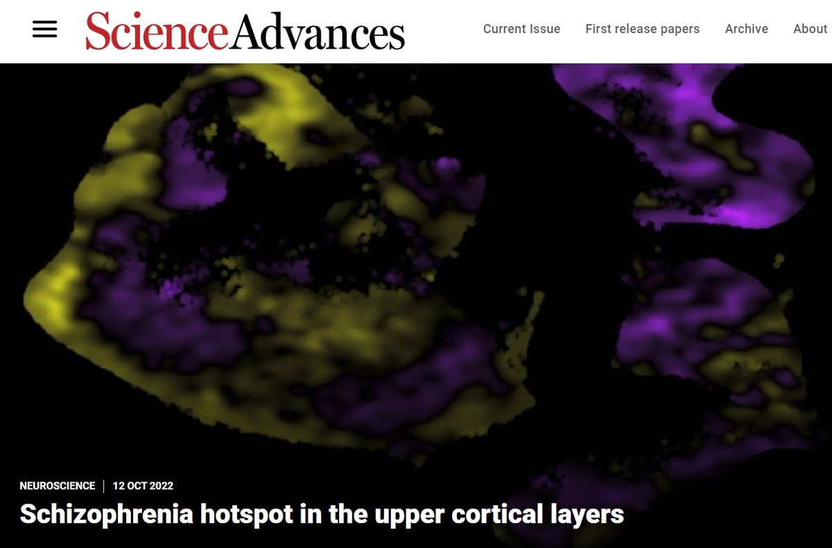 Khodosevich Lab (@khodosevichlab) on Twitter photo Published in <a href="/ScienceAdvances/">Science Advances</a> ! Study of schizophrenia by combination of single cell and spatial transcriptomics:
Upper cortical layer–driven network impairment in schizophrenia.
science.org/doi/10.1126/sc… Published in <a href="/ScienceAdvances/">Science Advances</a> ! Study of schizophrenia by combination of single cell and spatial transcriptomics:
Upper cortical layer–driven network impairment in schizophrenia.
science.org/doi/10.1126/sc…
