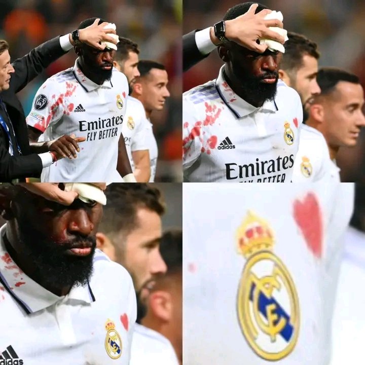 Un corazón pintado de sangre al lado del escudo del Real Madrid. Don Antonio Rüdiger. Tremendo. ❤️