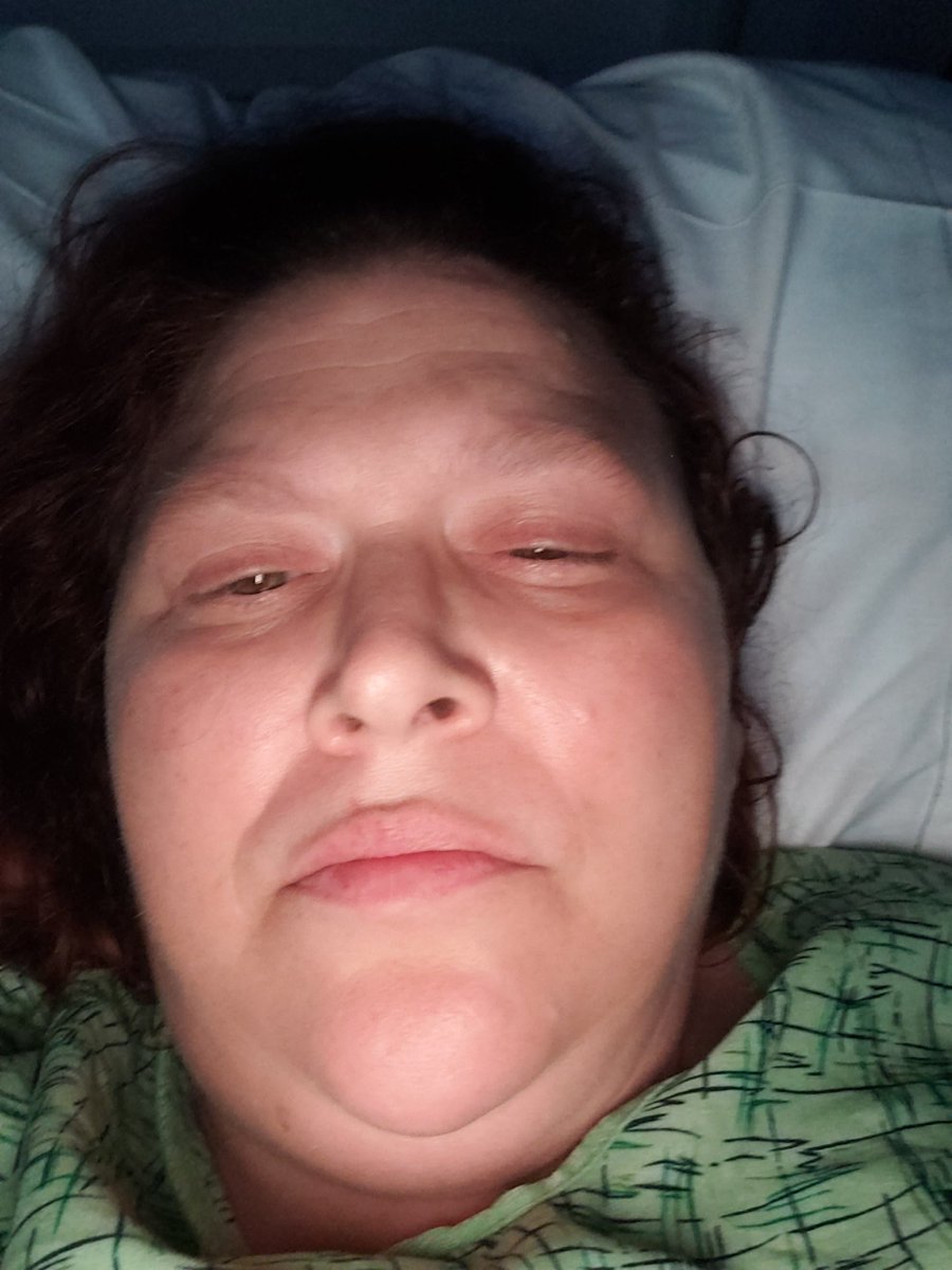 Kcbrooks76Kelly's tweet photo. @hoaghealth had to retweet u this stuff because the swelling is causing confusion &amp; Dr. Hoppe cant see swelling &amp; let me know ur can treat broken bones but can't diagnose. How are u ranked 4 in la and 9 in Ca if you cant diagnose or help people maybe USNews health needs an update https://t.co/SAKjvDlhVM