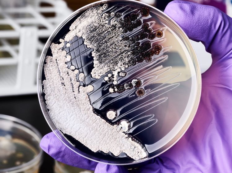 dissectmarkets's tweet photo. 1/ If there’s one business I’d put a big bet on for leading the new wave of innovation in this world, it would be Ginkgo Bioworks $DNA 🧬 

Thread 🧵 https://t.co/ZUL40ipbbk