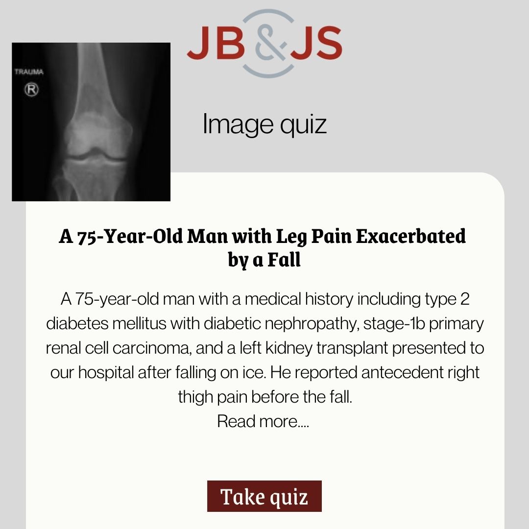 jbjs's tweet image. Read more and take the quiz: bit.ly/3VpANQG

#legpain #radiograph #imagequiz #orthopaedics