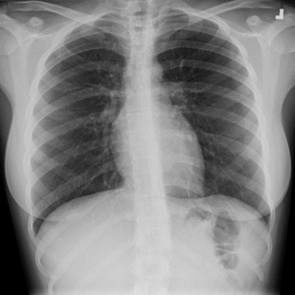 Society of Thoracic Radiology tweet media