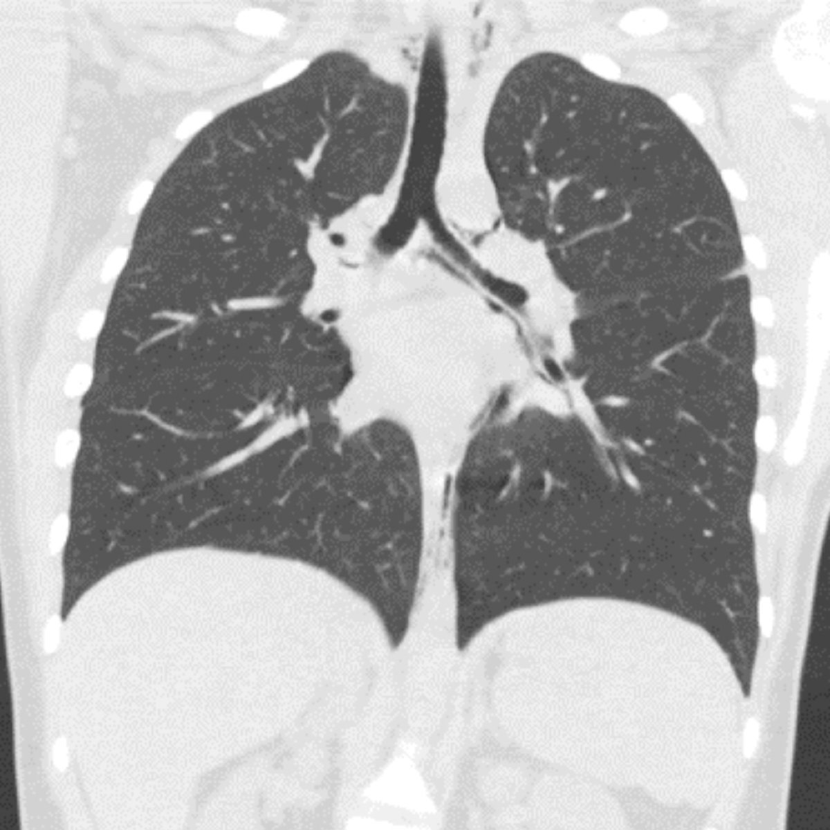 Society of Thoracic Radiology tweet media