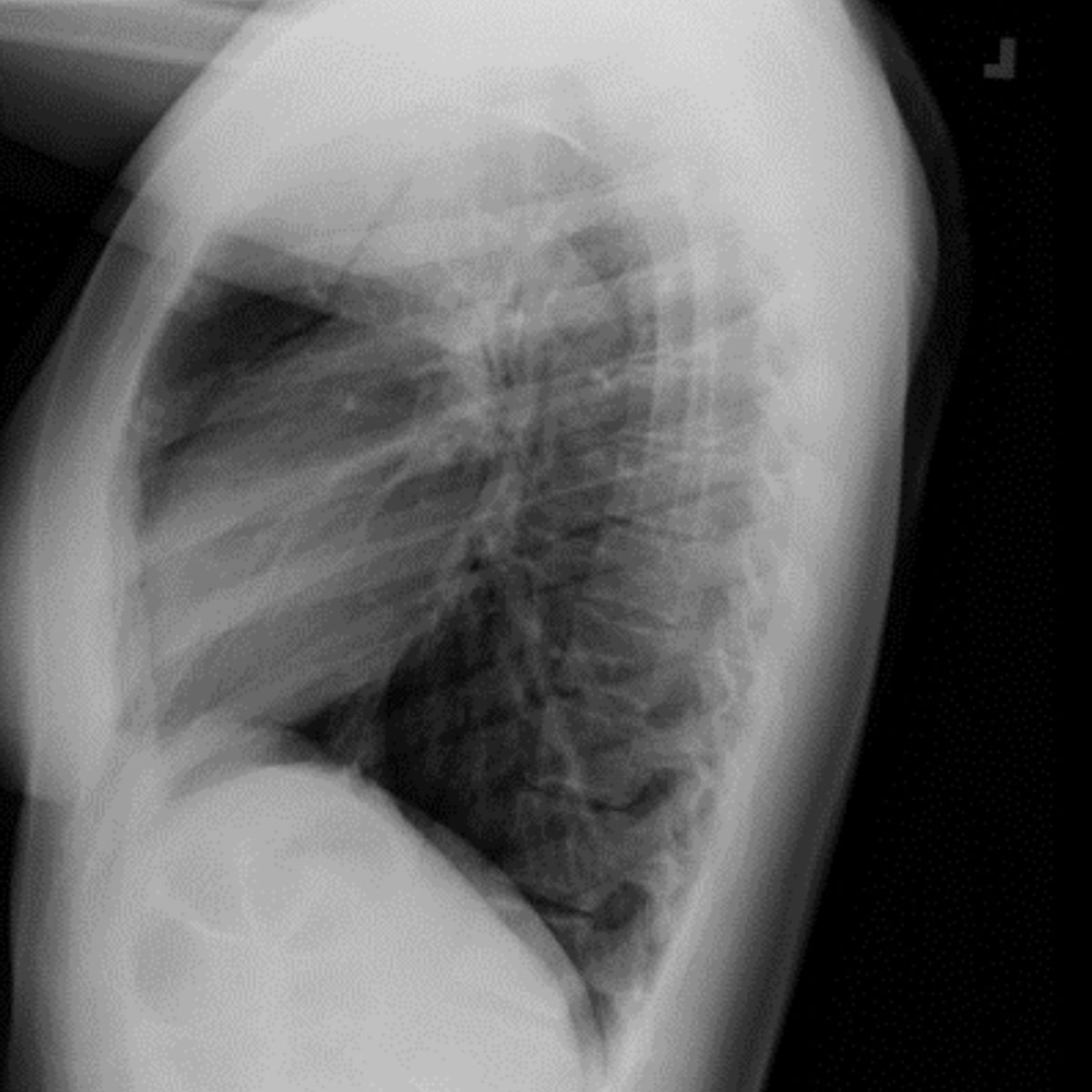 Society of Thoracic Radiology tweet media