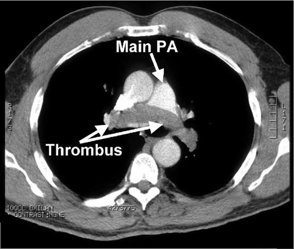 An ICU nurses’ response to this h.scum piece.

I bring you:

The 77 things I hated about what COVID...