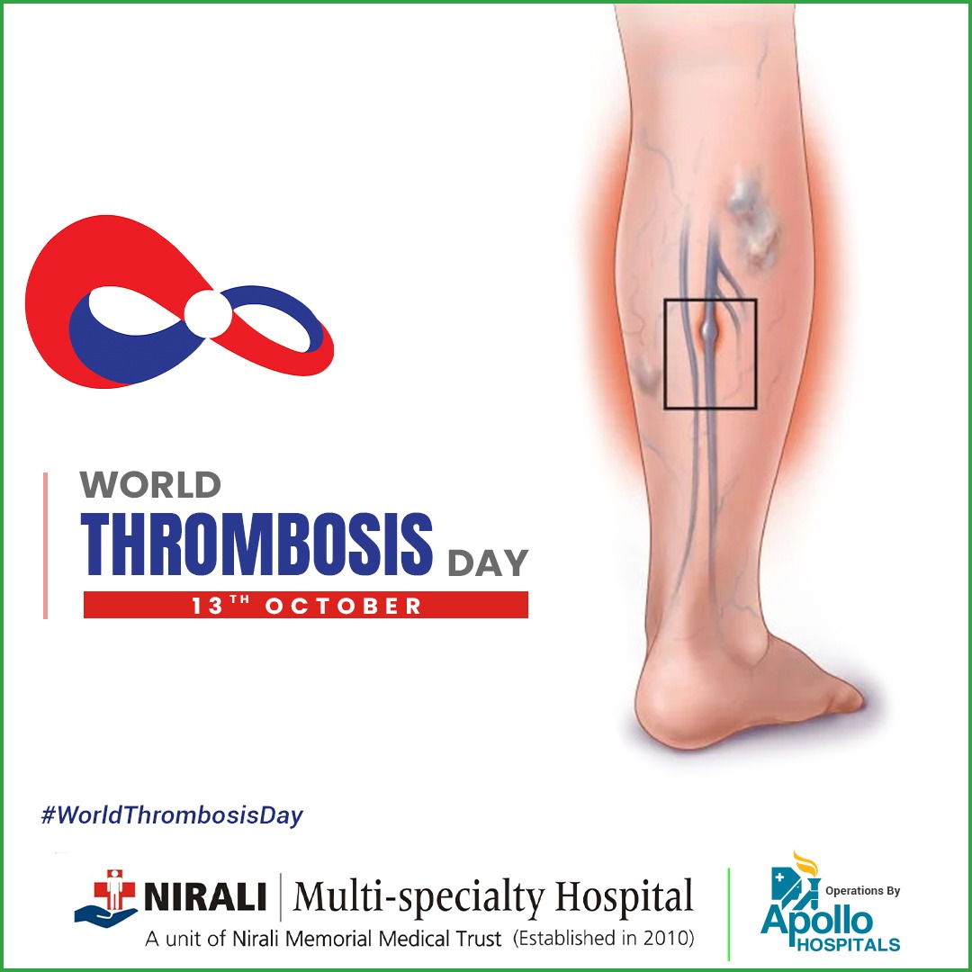 NiraliHospital's tweet photo. Thrombosis is a blood clot in arteries or veins. Getting these removed before it becomes risky is very important.
.
.
.
#niralimultispecialtyhospital #multispecialityhospital #WorldThrombosisDay #thrombosisday #13thOctober #13thOct #thrombosisresearch #thrombosisawareness https://t.co/XWcJ1qdsXB