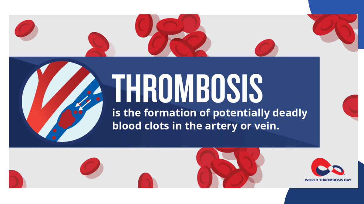 MMU Thrombosis Research Group (@mmu_thrombosis) on Twitter photo Today is #WorldThrombosisDay
#thrombosis is the formation of a #blood clot.
#Research <a href="/MMU_thrombosis/">MMU Thrombosis Research Group</a> <a href="/mmucvrg/">MMU Cardiovascular Research Group</a> <a href="/MMU_CBS/">MMU Centre for Bioscience</a> is focused on understanding why thrombosis occurs so that we can develop better therapies!
We’ll be highlighting our incredible team and their work today! Today is #WorldThrombosisDay
#thrombosis is the formation of a #blood clot.
#Research <a href="/MMU_thrombosis/">MMU Thrombosis Research Group</a> <a href="/mmucvrg/">MMU Cardiovascular Research Group</a> <a href="/MMU_CBS/">MMU Centre for Bioscience</a> is focused on understanding why thrombosis occurs so that we can develop better therapies!
We’ll be highlighting our incredible team and their work today!