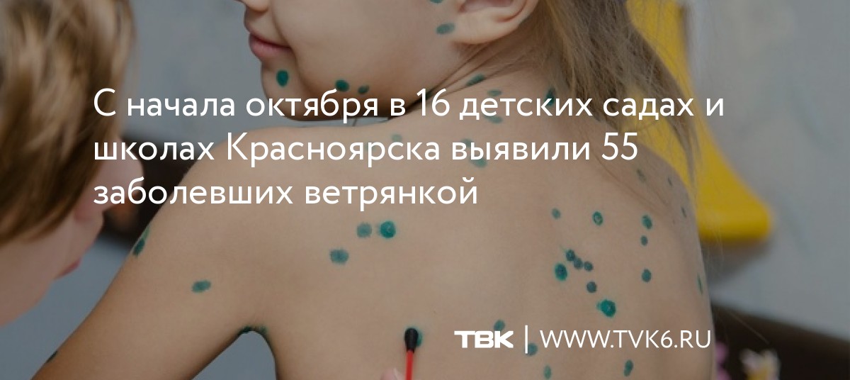 С начала октября в 16 детских садах и школах Красноярска выявили 55 заболевших ветрянкой dlvr.it/Sb01xC
