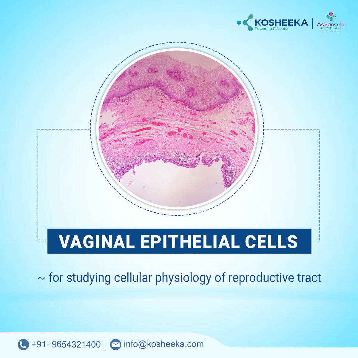 kosheeka's tweet photo. Vaginal epithelial cells can be used in studying various reproductive tract-related research. Get in touch with us to procure high-quality vaginal epithelial cells.
#stemcellawareness #stemcells #kosheeka
#stemcellresearch #stemcellresearchers #healthcare https://t.co/vYq9TGhP0a