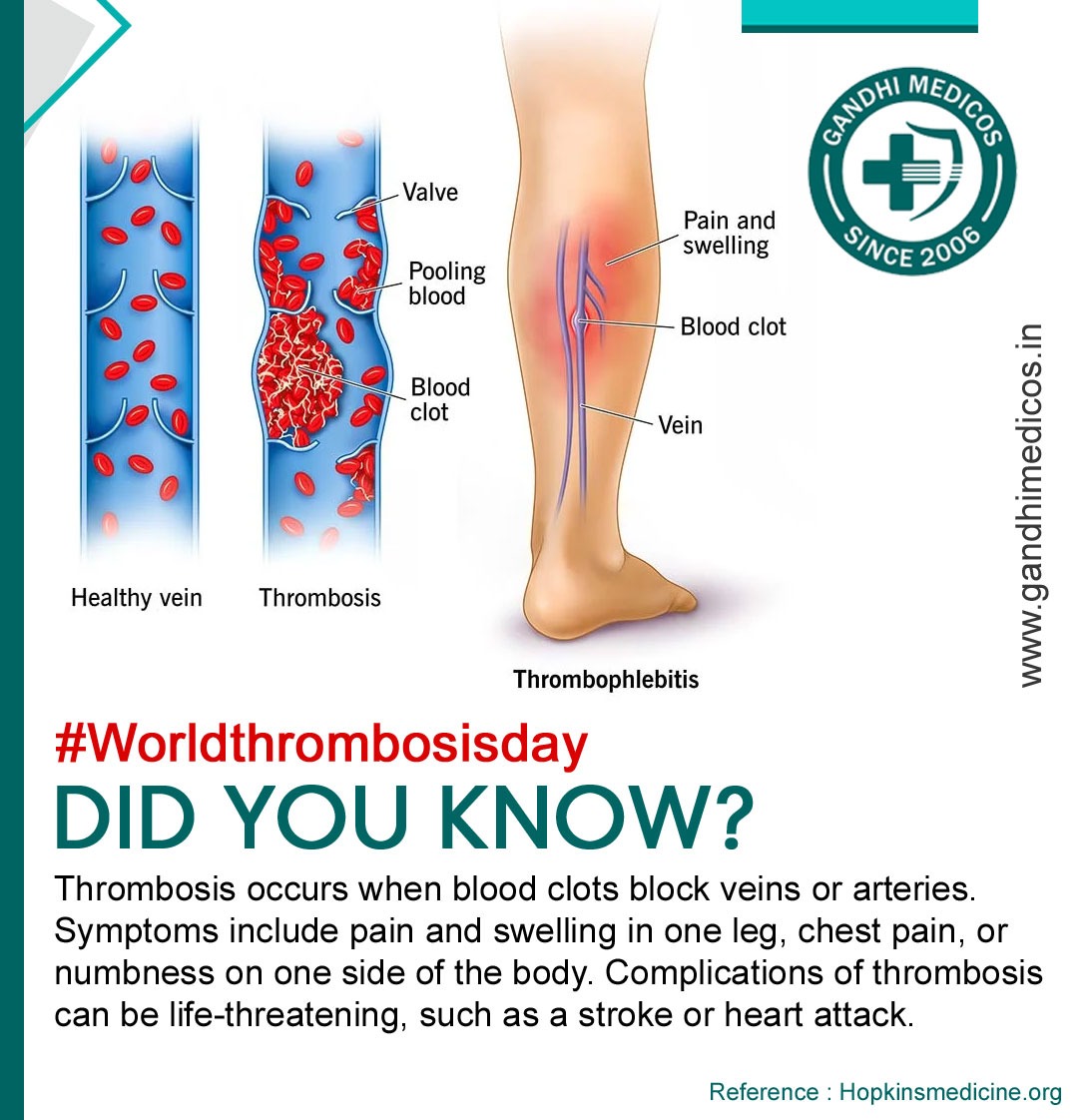 GandhiMedicos's tweet photo. #KeepLifeFlowing
World Thrombosis Day - "Early diagnosis and right treatment can help us save the lives of the sufferers."
#oncology #HIV #import #export #EMS #FedEx #Health #Mexico #USA #Canada #philippines #bloodclots #deepveins #worldthrombosisday #bloodclotsblock #arteries https://t.co/79w4Xg3c76