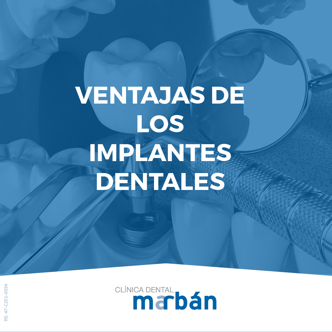 ¿Por qué colocar un #implante ?

1️⃣ Recuperamos la función masticatoria.
2️⃣ Recuperamos la estética 
3️⃣ Recuperamos una buena comunicación verbal y funcional.
4️⃣ Damos una mayor y mejor calidad de vida.

#ClinicaDentalMarban #dentistavalladolid
