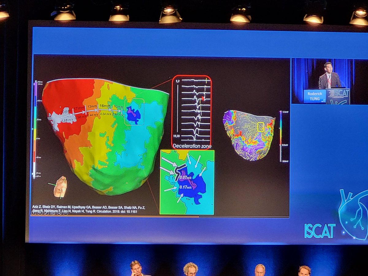 rythmo_sfc's tweet photo. Amazing presentation about wavefront discontinuity mapping by the master @DrRoderickTung
#ILAM #ISCAT2022 https://t.co/G8ABGarI09