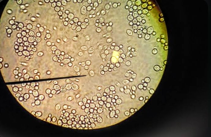 Anadolu Lisesi 10.sınıf öğrencilerimiz ile biyoloji laboratuvarında 'Bira Mayasında Eşeysiz Üreme' incelemesi yaptık.