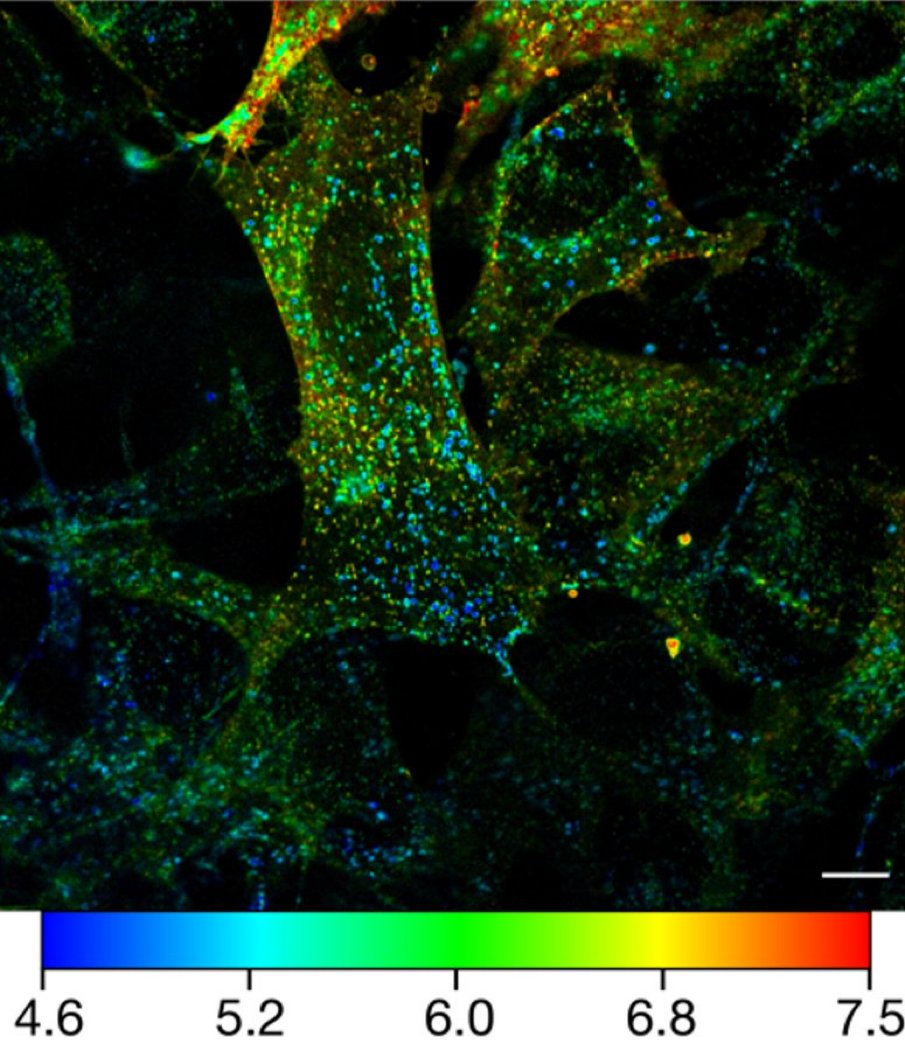 NanoMB (@bio_nano) on Twitter photo Congratulations Josh on another great paper in <a href="/NatureComms/">Nature Communications</a> quantifying sub cellular pH and helping to debunk the proton sponge effect. rdcu.be/cXq99 <a href="/MIPS_Australia/">Monash Institute of Pharmaceutical Sciences</a> #Microscopy #CellBiology Congratulations Josh on another great paper in <a href="/NatureComms/">Nature Communications</a> quantifying sub cellular pH and helping to debunk the proton sponge effect. rdcu.be/cXq99 <a href="/MIPS_Australia/">Monash Institute of Pharmaceutical Sciences</a> #Microscopy #CellBiology