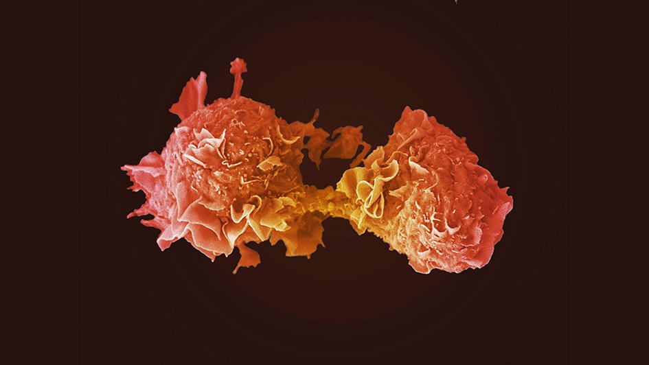 RMresearch_'s tweet photo. #ICYMI: A combo treatment of #immunotherapy w/ an experimental drug may reverse #cancer's resistance to #immunotherapy, a study led by @ICR_London @royalmarsdenNHS has found
Find out more 👉https://t.co/sfLLabGB0T #FutureOfCancer #WhyWeDoResearch https://t.co/khtZ9pUKKb