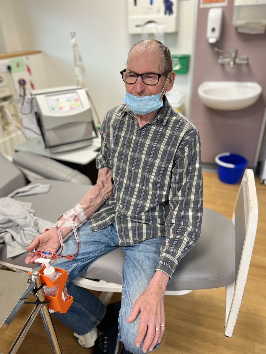 We explain to our patients needing dialysis that when possible, a fistula is the most durable and effective form of vascular access. 
Well here is living evidence! 
Our patient had his fistula made in 1975 and it’s working perfectly. 
<a href="/ImperialNHS/">Imperial NHS 💙</a>