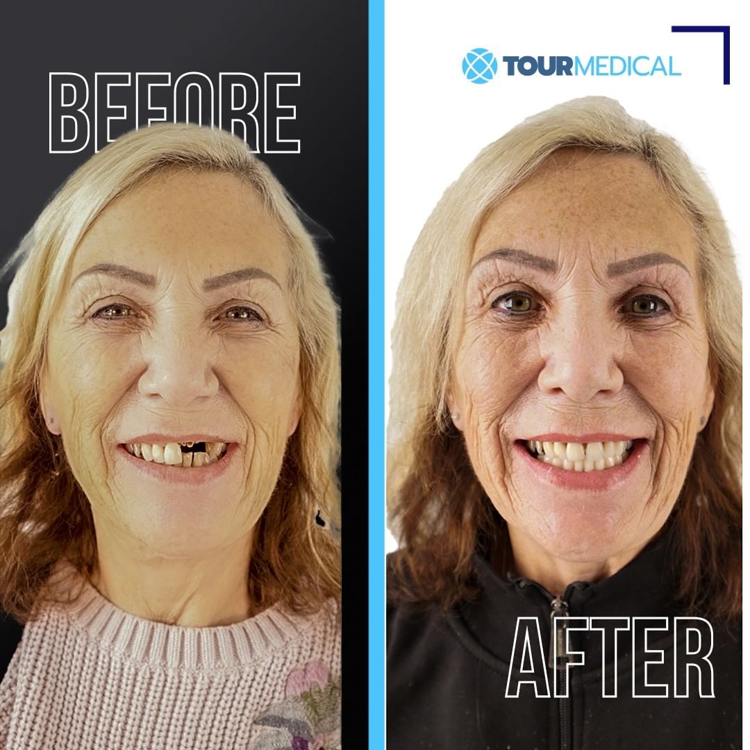 Tourmedical's tweet photo. ✈️TourMedical Health Tourism
🌐 https://t.co/EMLM87E78E
📞 +90 539 412 85 00
📞 +90 539 412 85 25 https://t.co/uilIrVzxmU