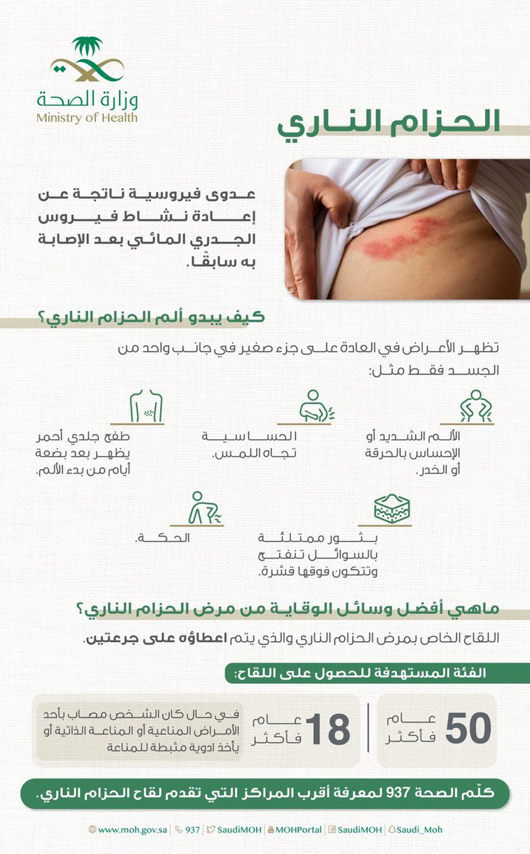 JoufHealth2's tweet photo. هل أنت بحاجة إلى لقاح الحزام الناري؟ 
تعرّف على هذا المرض للوقاية منه. https://t.co/7V0uXFOjx8