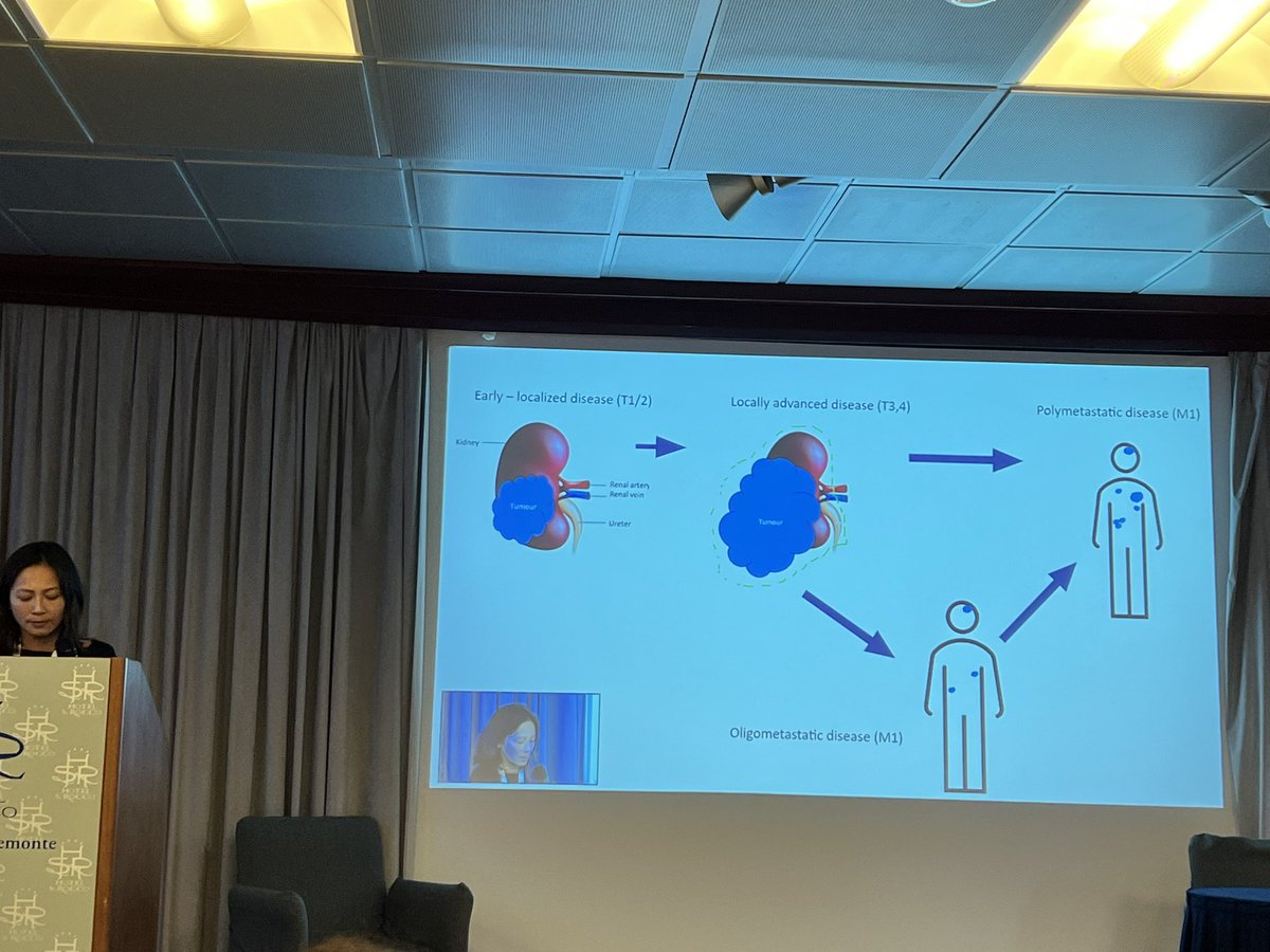 IKCC Kidney Cancer (@ikccorg) on Twitter photo <a href="/MaxineGBTran/">Maxine Tran</a> presenting on oligometastatic #KidneyCancer. oligo’ = ‘a few’ (≤ 5) Defined as distinct cancer state between locally confirmed and systemically metastasized disease. Appear synchronous = at time of diagnosis of primary tumour or Metachronous = later #ikcc2022 <a href="/MaxineGBTran/">Maxine Tran</a> presenting on oligometastatic #KidneyCancer. oligo’ = ‘a few’ (≤ 5) Defined as distinct cancer state between locally confirmed and systemically metastasized disease. Appear synchronous = at time of diagnosis of primary tumour or Metachronous = later #ikcc2022