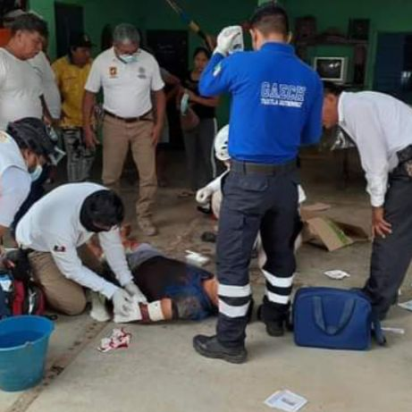 CrimesReais's tweet photo. Pitbull quase arranca o braço de ladrão que tentou entrar em uma casa para roubar. https://t.co/33hdoaxwas