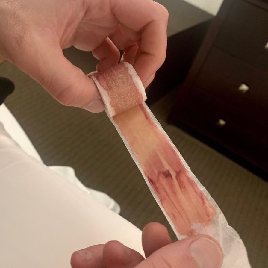 Alex Ciccimarro (@TheBaldGod) / Twitter