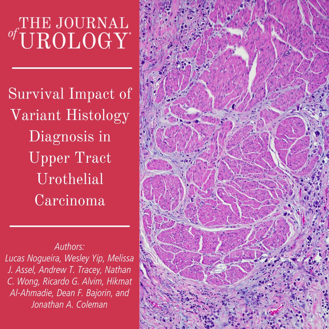 "We sought to evaluate the impact of variant histology UTUC on patient survival outcomes at our institution."

bit.ly/3rPNyWU