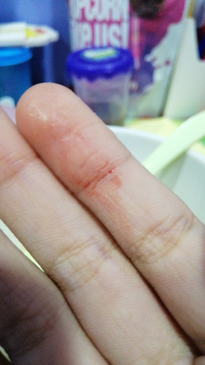 berryTuber's tweet image. OMG AM I GONNA DIE I'M NOT READY TO DIE