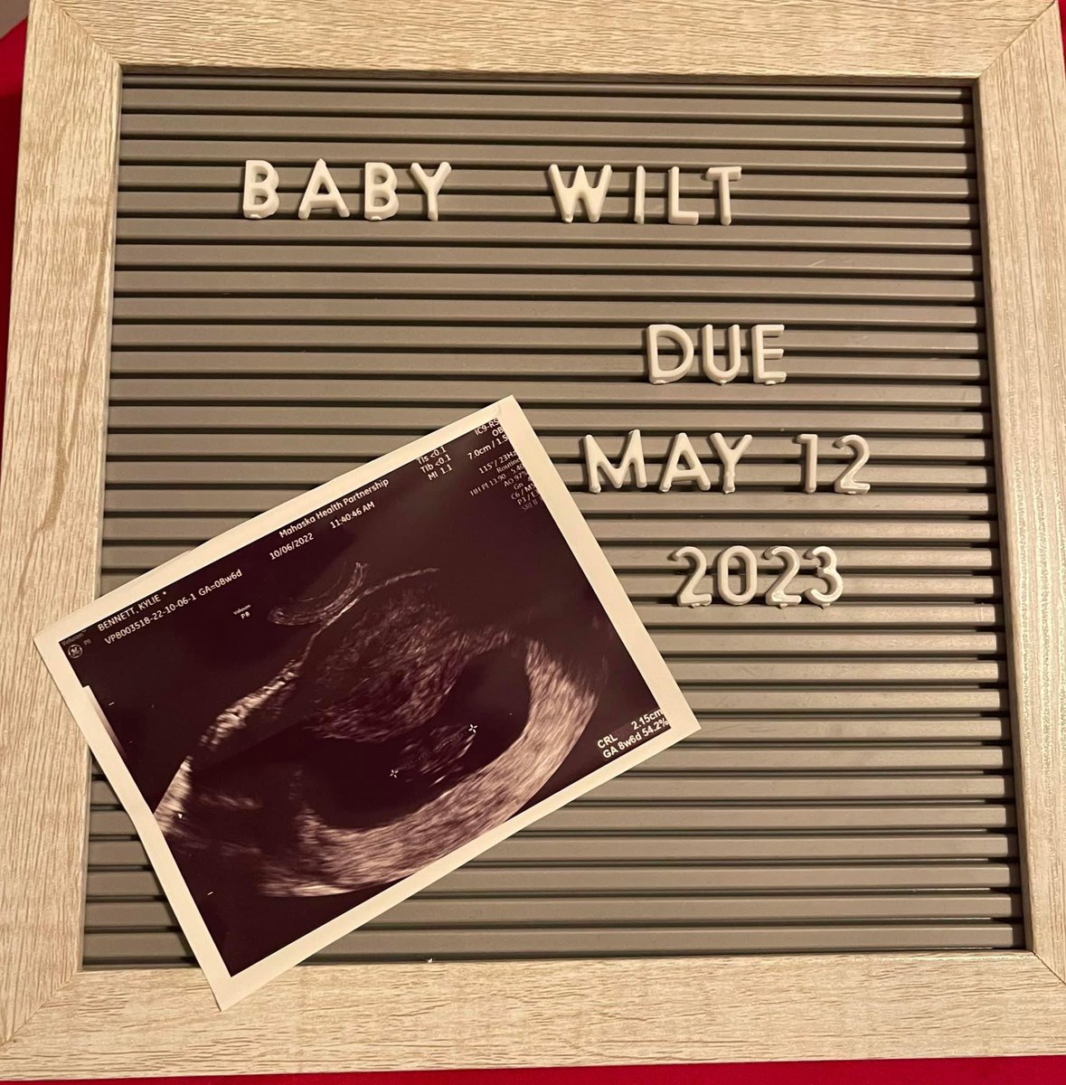 Damn, I guess this is really happeneing 😅